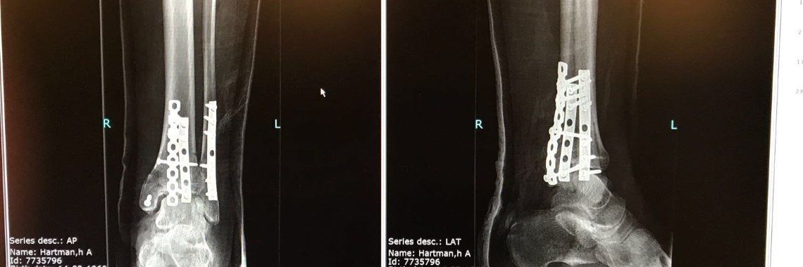 Wat overkomt mij nou, deel 2 | Ad Hartman